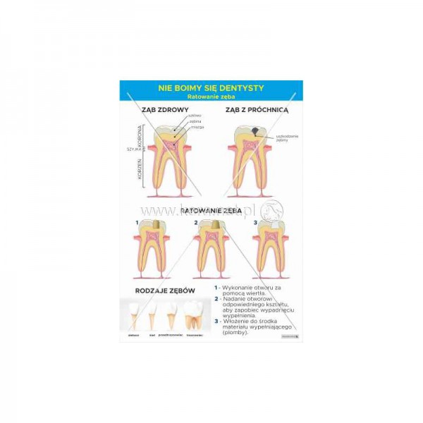 Nie boimy się dentysty - ratowanie zęba plansza 70x100 cm